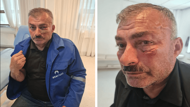 Ağcəbədidə “Azəriqaz”ın əməkdaşına xəsarətlə bağlı cinayət işi açıldı