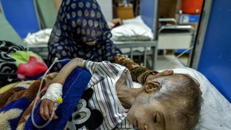 6 milyon əfqan aclıq təhlükəsi ilə üz-üzə: Onlar bu qışdan sağ çıxmaya bilər - BMT