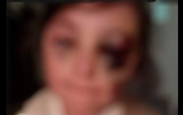 Məktəblinin döyülməsi iddiaları təsdiqini tapmayıb - DİN