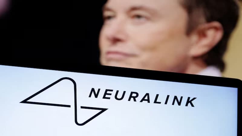 Maskın “Neuralink” şirkəti ikinci xəstənin beyninə uğurla çip yerləşdirdi