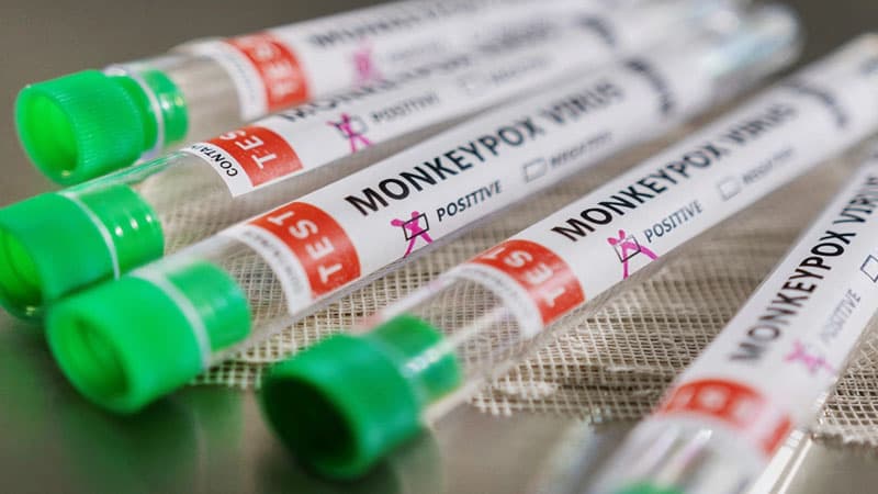 Meymunçiçəyi virusuna qarşı antibiotiklərdən istifadə oluna bilər? (RƏSMİ)