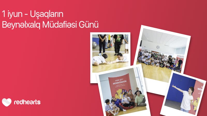 Hər şey mümkündür: Daun sindromlu uşaqlar üçün sosial layihə