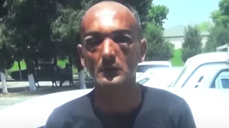 Toya gedən şəxs döyüləndən 9 gün sonra ölüb (VİDEO)