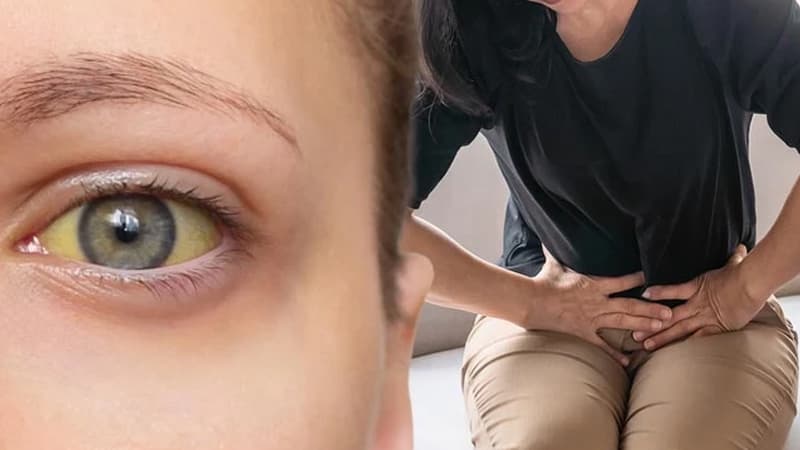 Dərinizdəki bu dəyişiklik ən ölümcül xərçəng növlərindən birinə işarə ola bilər - DİQQƏT