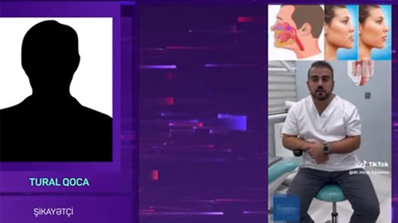 "Dişimi çəkdirmək mənə 500 manatdan çox başa gəldi, ölümdən də döndüm" (VİDEO)