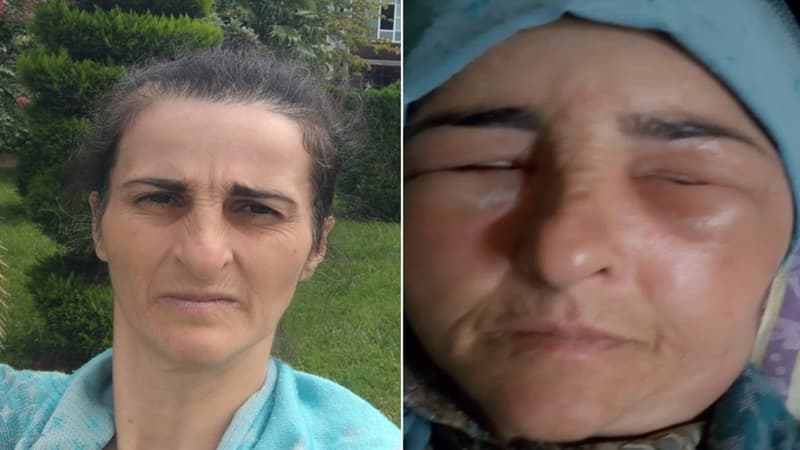 ​​​​​​​Lənkəranda qonşular arasında dava olub, xəsarət alan var