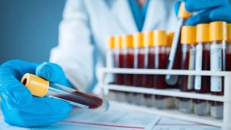 Həyat tərziniz genetikanızla uyğun gəlirmi? - Bu testlər sizi gələcəyə hazırlayır