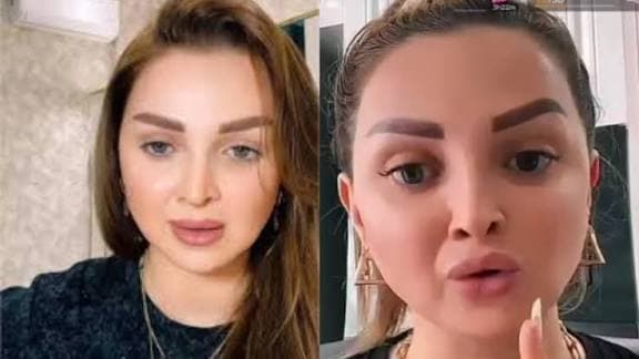 Tiktoker "Beniz": "Bir ildə "TikTok"dan 306 min manat qazanmışam"