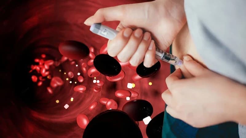 2050-yə qədər xəstə sayı 850 milyonu keçəcək - Bu, epidemiya sayıla bilərmi?