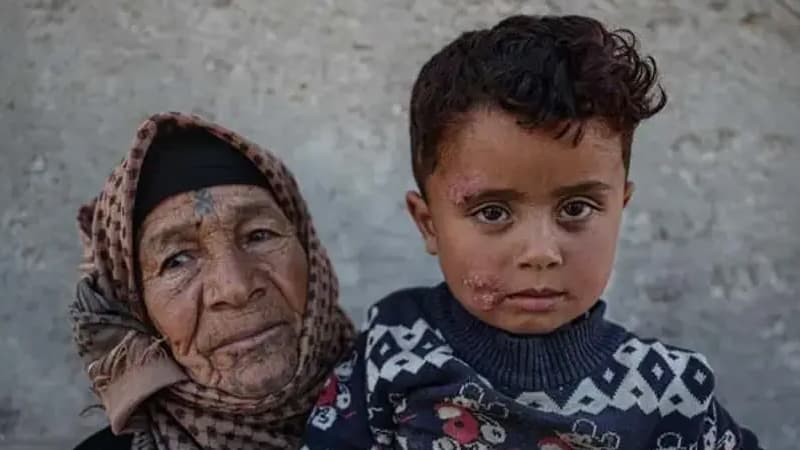 Suriyada qorxunc xəstəlik yayılır: Artıq 1500 nəfər yoluxub (FOTO)