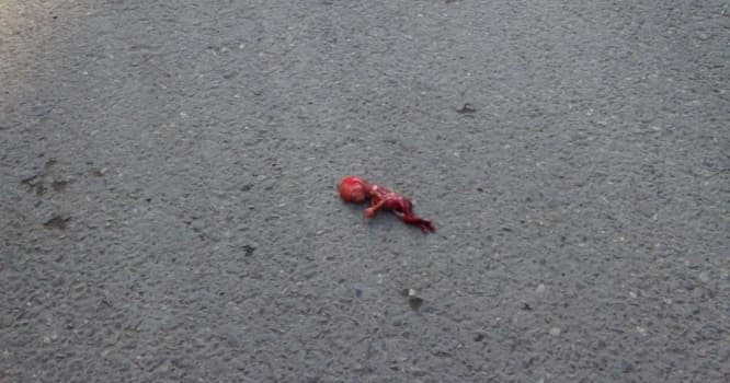 Bakının mərkəzində dəhşət: abort qalıqları yolun ortasına düşdü - FOTO/VİDEO