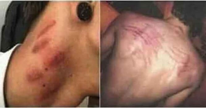 Bakıda mazaxist qadın sevgilisini qana boyadı - ŞOK FOTO