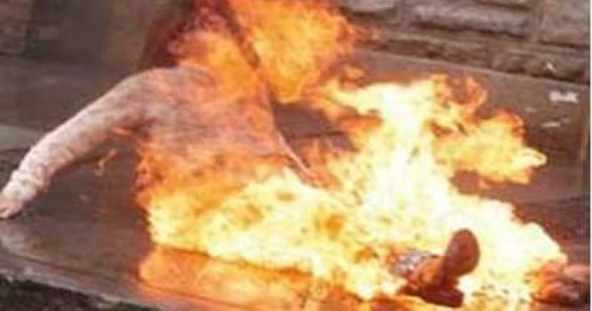 Bakıda transformator məntəqəsinə daxil olan uşaq yandı