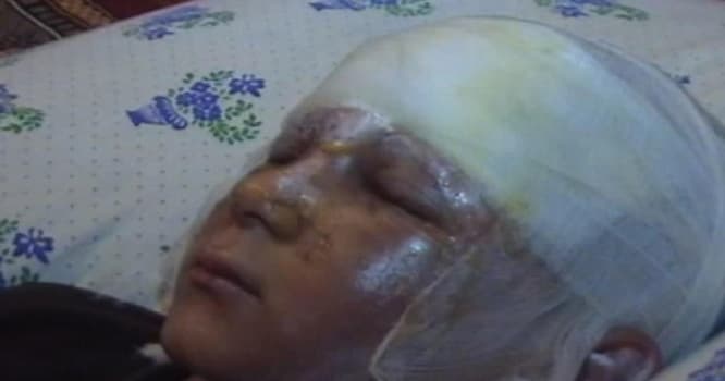 Tərtərdə hərbi sursat partlayıb, 8 yaşlı uşaq xəsarət alıb