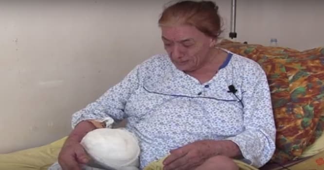 87 yaşlı qadının digər ayağı da kəsildi