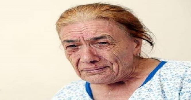 Səhvən sağ ayağı kəsilən qadın haqda nazirlikdən şərh