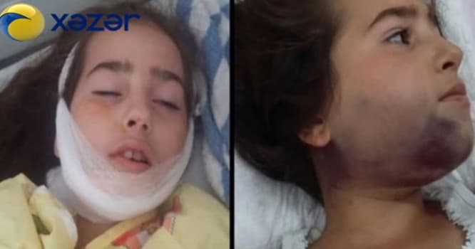 10 yaşlı uşağı 9-cu mərtəbədən atdılar - Sağ qaldı + Video