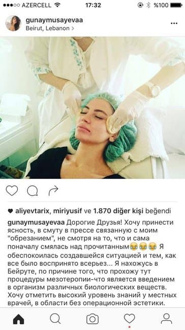 Günaydan sünnət açıqlaması: "Çox güldüm"