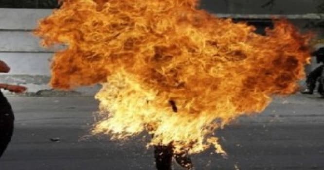 45 yaşlı kişi özünü yandırdı
