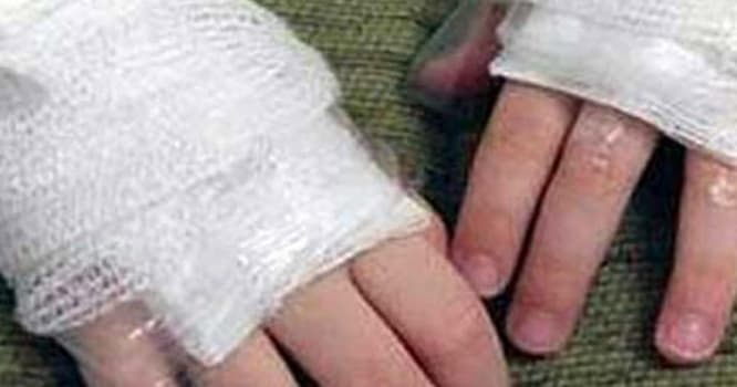 Tovuzda 3, Salyanda 5 yaşlı uşaq yandı