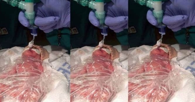 Yeni doğulan körpəni anası küçəyə atdı - Belə xilas edildi... - FOTOLAR