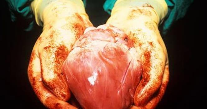 15 ildir aparata bağlı olan xəstə ürəyini satışa çıxardı