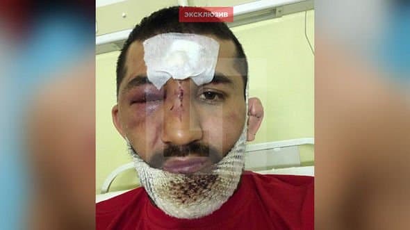 Cinayətkarlar dünya çempionunu bu hala saldılar - FOTO