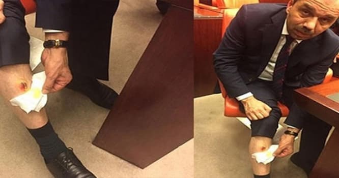 Davada deputatın ayağını da dişləyiblər