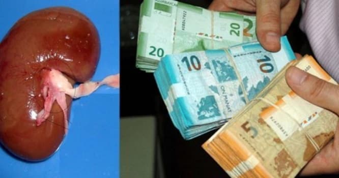 Azərbaycanda ata böyrəyini satır: "Uşağı acından öldürəsi deyiləm ki..."