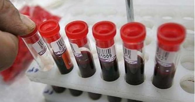 Pulsuz dərmanla təmin edilən hepatitli xəstələrin sayı açıqlandı