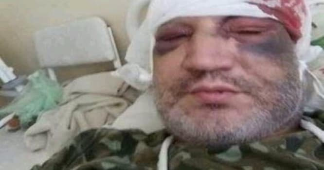Azərbaycanlı sürücünün maşınını yandırıb, özünü ölümcül döydülər - FOTOLAR