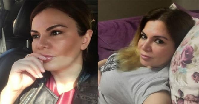 Ülvira dördüncü dəfə plastik əməliyyat etdirdi