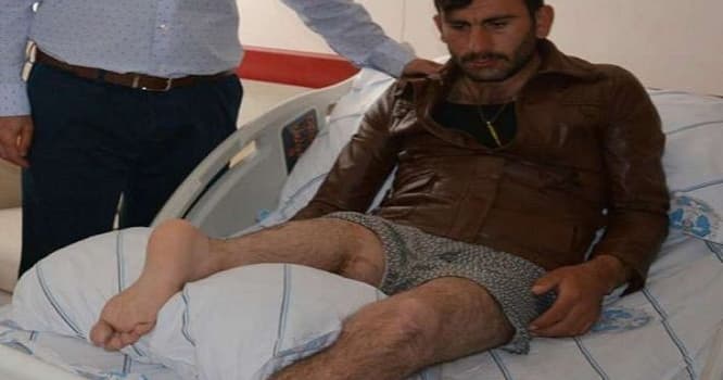 Türkiyədə qəribə hadisə: Həkimlər ayağını tərs tikdilər
