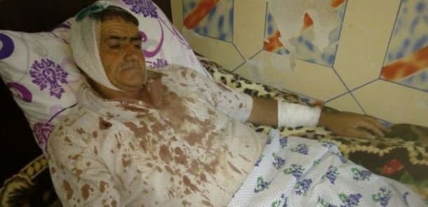 İmişlidə kütləvi dava: ata və üç oğlunu döydülər (FOTOLAR)