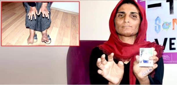 17 il cəhənnəm əzabı yaşadı, 11 barmağı kəsildi, hər gün döyüldü (FOTO)