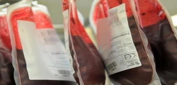 Azərbaycanda anemiyadan əziyyət çəkən uşaqların sayı artıb