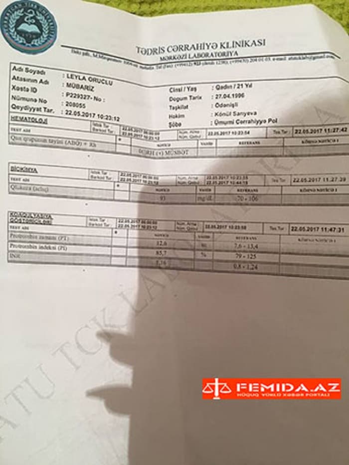 Leylanın anası: "Qızımı əməliyyata gözündə linza, saçında qaynaqla salmışdılar"