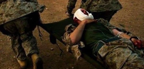 Qoşunların təmas xəttində erməni hərb&ccedil;isi &ouml;l&uuml;b