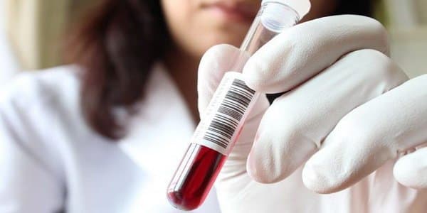 Azərbaycanda təhlükəli viruslarla bağlı vəziyyət açıqlandı