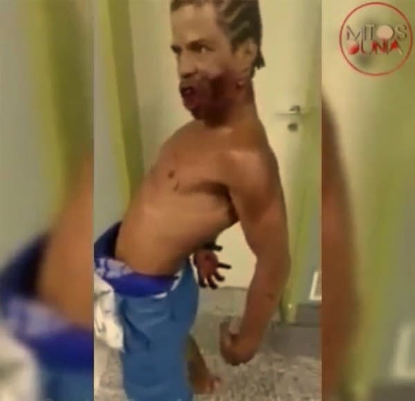 İnsanı zombiyə çevirən narkotik maddə dünyaya yayılır (FOTO)