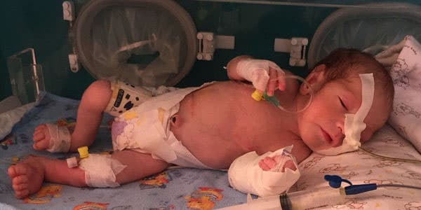 Bakıda 1 yaşlı Yusifi qıza çevirdilər (FOTOLAR)