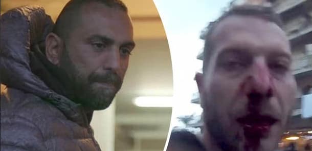 Jurnalistin verdiyi sual ona baha başa gəldi: canlı yayımda burnunu qırdılar (VİDEO)