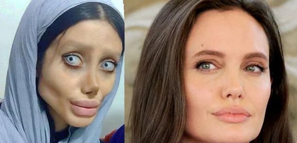Ancelinaya bənzəmək istədi, "insanlıqdan çıxdı" (FOTOLAR)