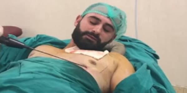 Azərbaycanlı həkim özünü əməliyyat etdi (VİDEO)