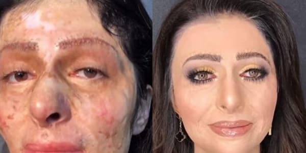 Ermənilər Anarın videosunu paylaşdı, dava düşdü (FOTO/VİDEO)