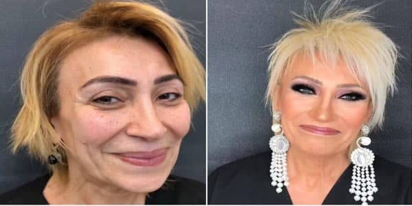 Anar əməkdar artisti tanınmaz hala saldı (VİDEO)