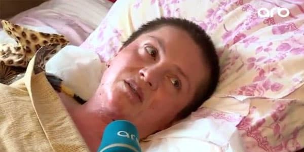 Bədəninin 85 faizi yanan ananın fəryadı: “Körpəm məndən qorxur” (FOTO/VİDEO)