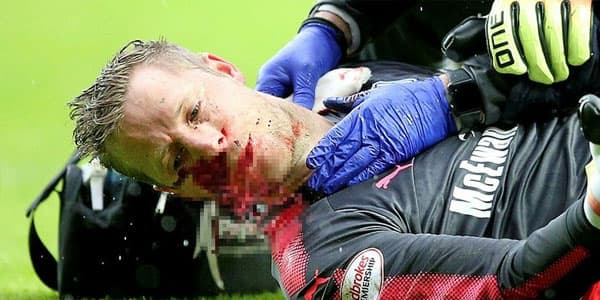 Futbolçu meydanda qana boyandı (FOTOLAR)