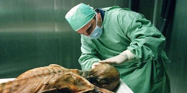 Ölmüş insanların beyinləri bərpa ediləcək - İNANILMAZ YENİLİK