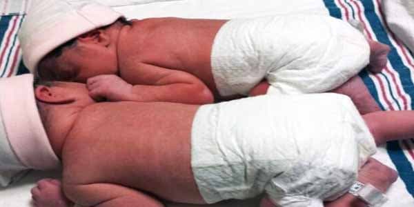 Azərbaycanda ekstremal çəkidə doğulan uşaqların sayı artır